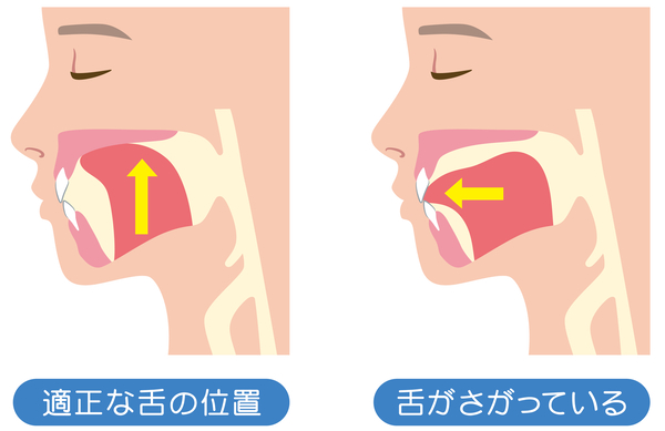 京橋 銀座みらい歯科｜歯科衛生士ブログ｜歯列接触癖（TCH）について｜画像2