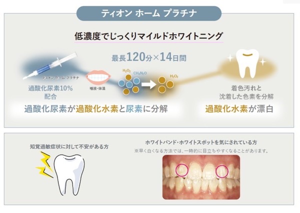 京橋 銀座みらい歯科｜歯科衛生士ブログ｜ホームホワイトニングウィズが新登場！｜画像2